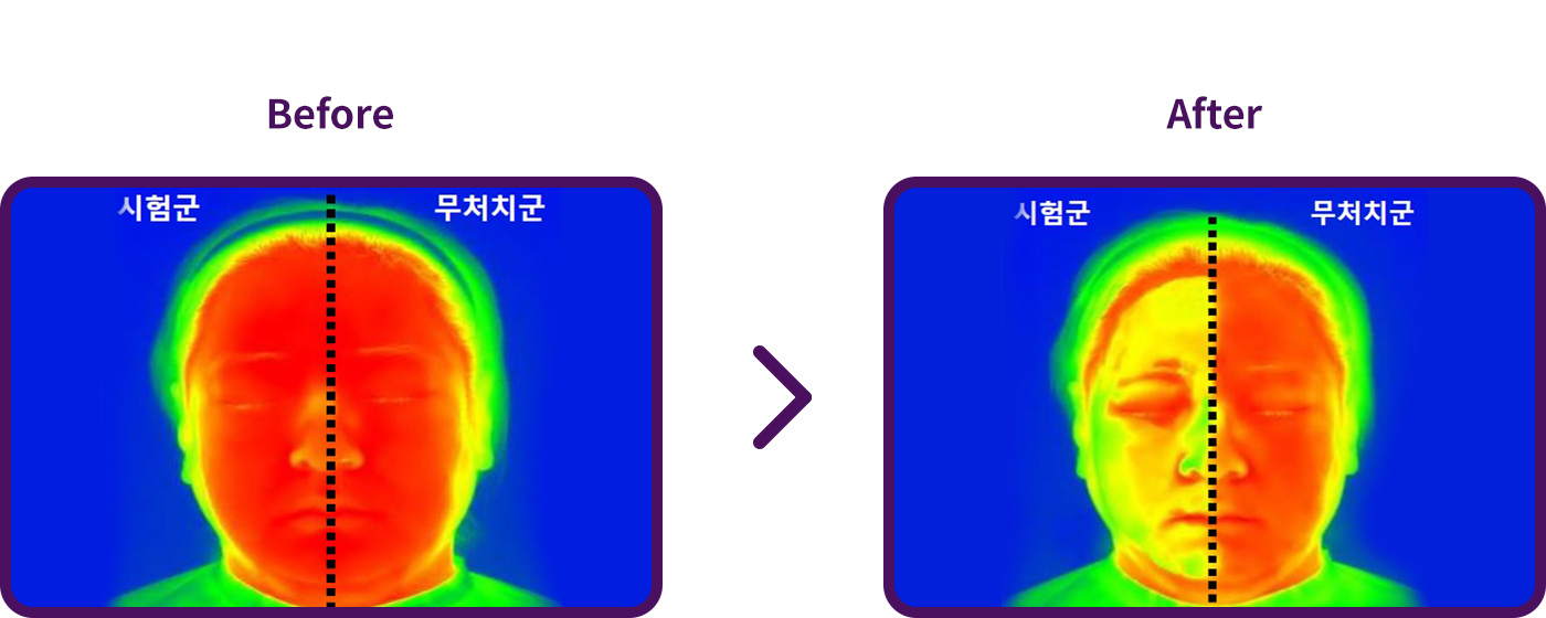 쿨링(온도감소)/온열 평가 비포애프터 이미지